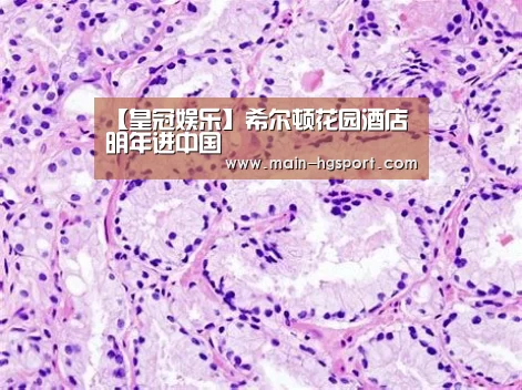 【皇冠娱乐】希尔顿花园酒店明年进中国(图1) 皇冠体育